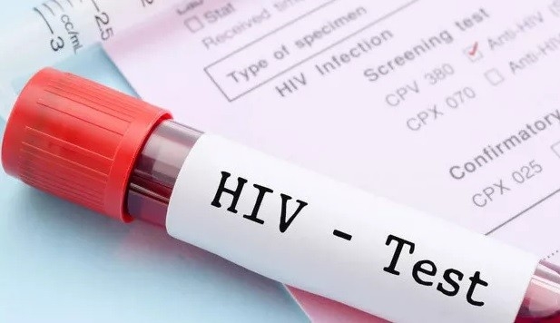 1,5 milyon yeni HIV vakası dünyayı tehdit ediyor
