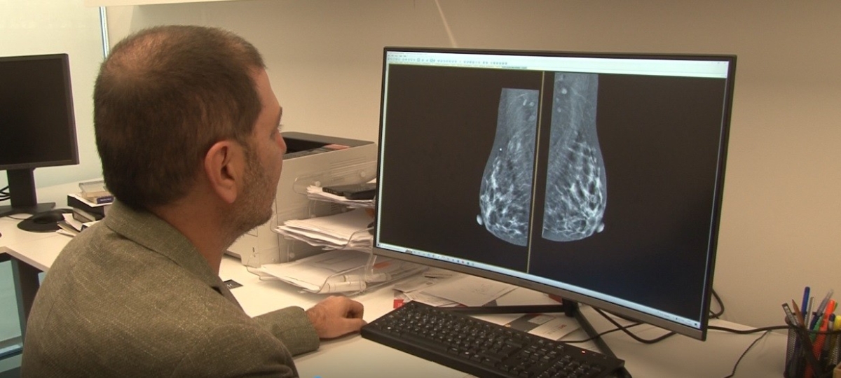 Mamografi işlemi ile ilgili efsaneler yeni cihazlarla son buldu
