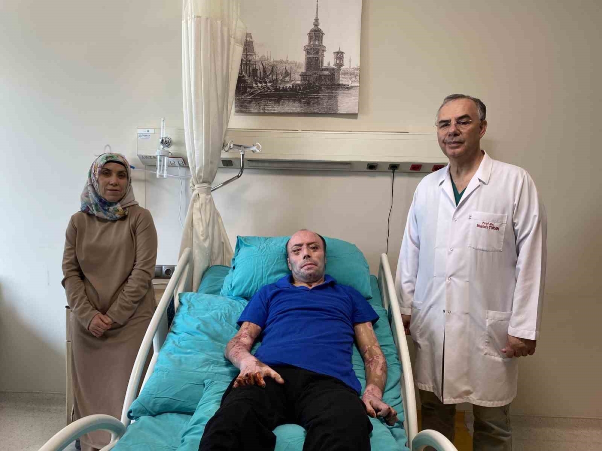140 ameliyat geçiren 8 ayı aşkın süre hastanede kalan maden işçisi İzzet Ak taburcu edildi
