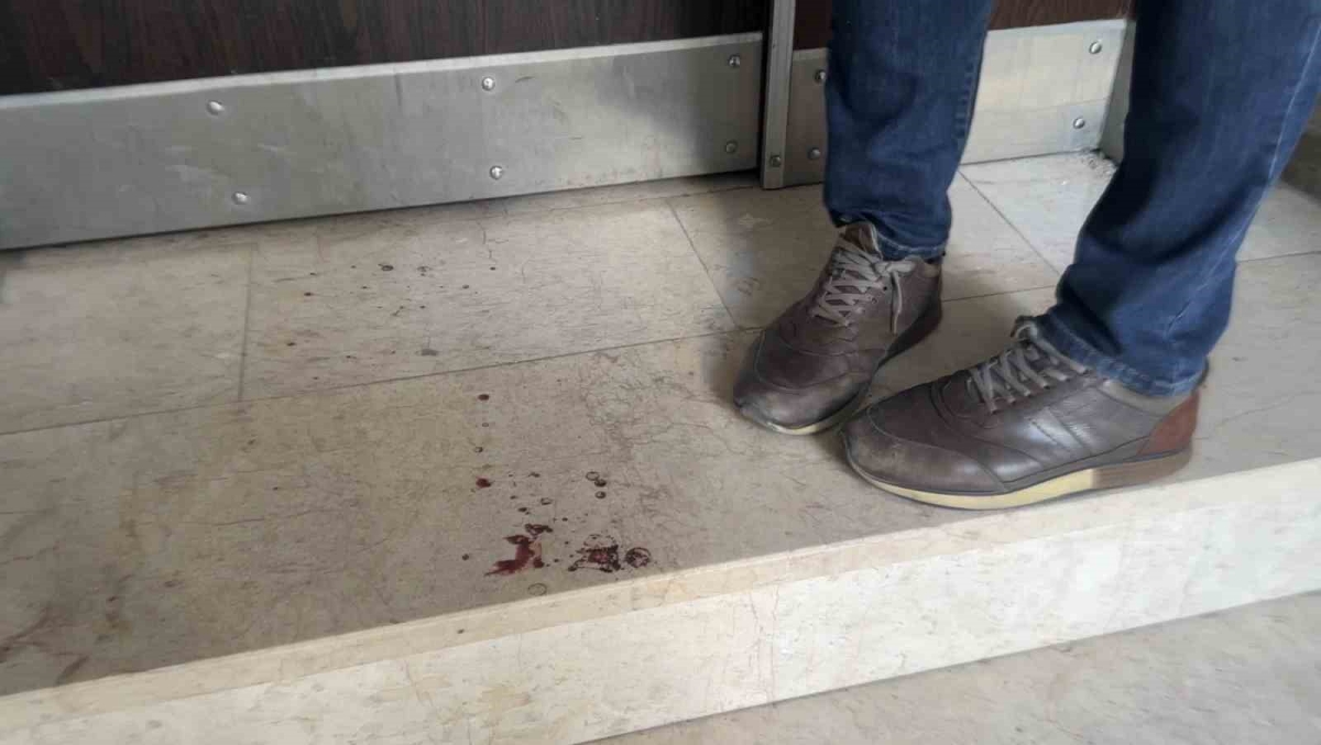 İstanbul’da üniversite öğrencisi genç kıza bıçaklı saldırı: “Abi korkuttun beni” dediği şahıs belinden bıçakladı
